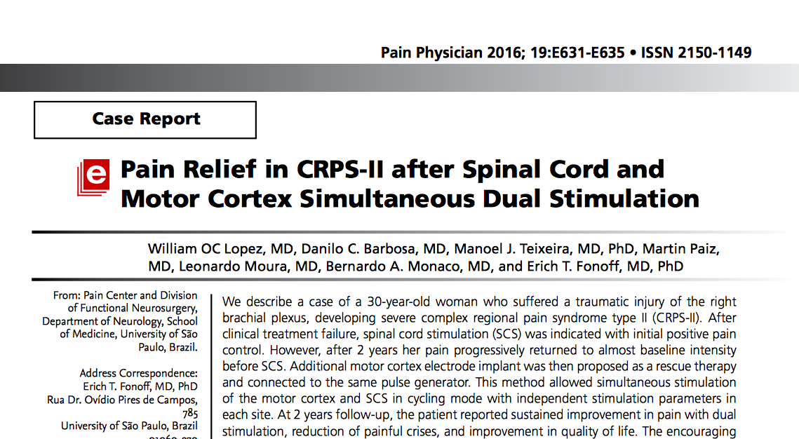 Síndrome de Dor Regional Complexa; Causalgia; Distrofia Simpático-Reflexa; Estimulação Medular; Estimulação Cortical