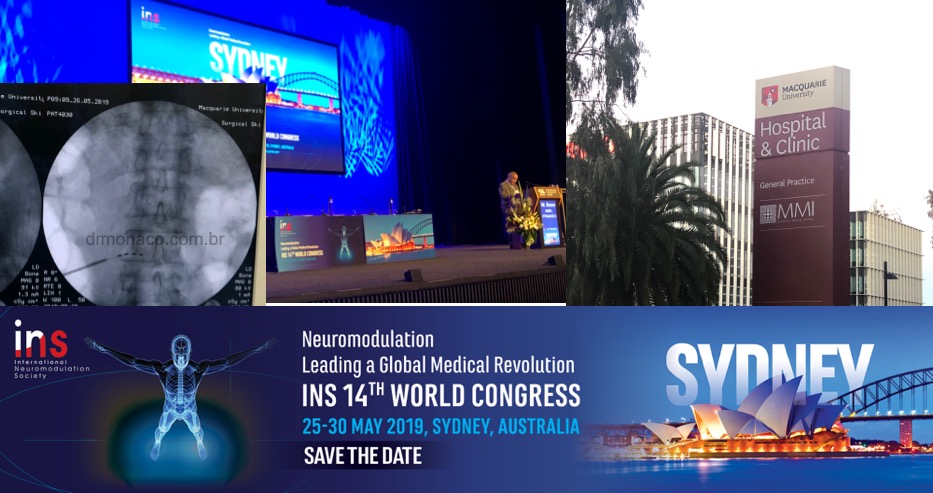 Congresso INS-Sydney 2019 - Dr. Monaco Congresso INS-Sydney 2019 - Dr. Monaco