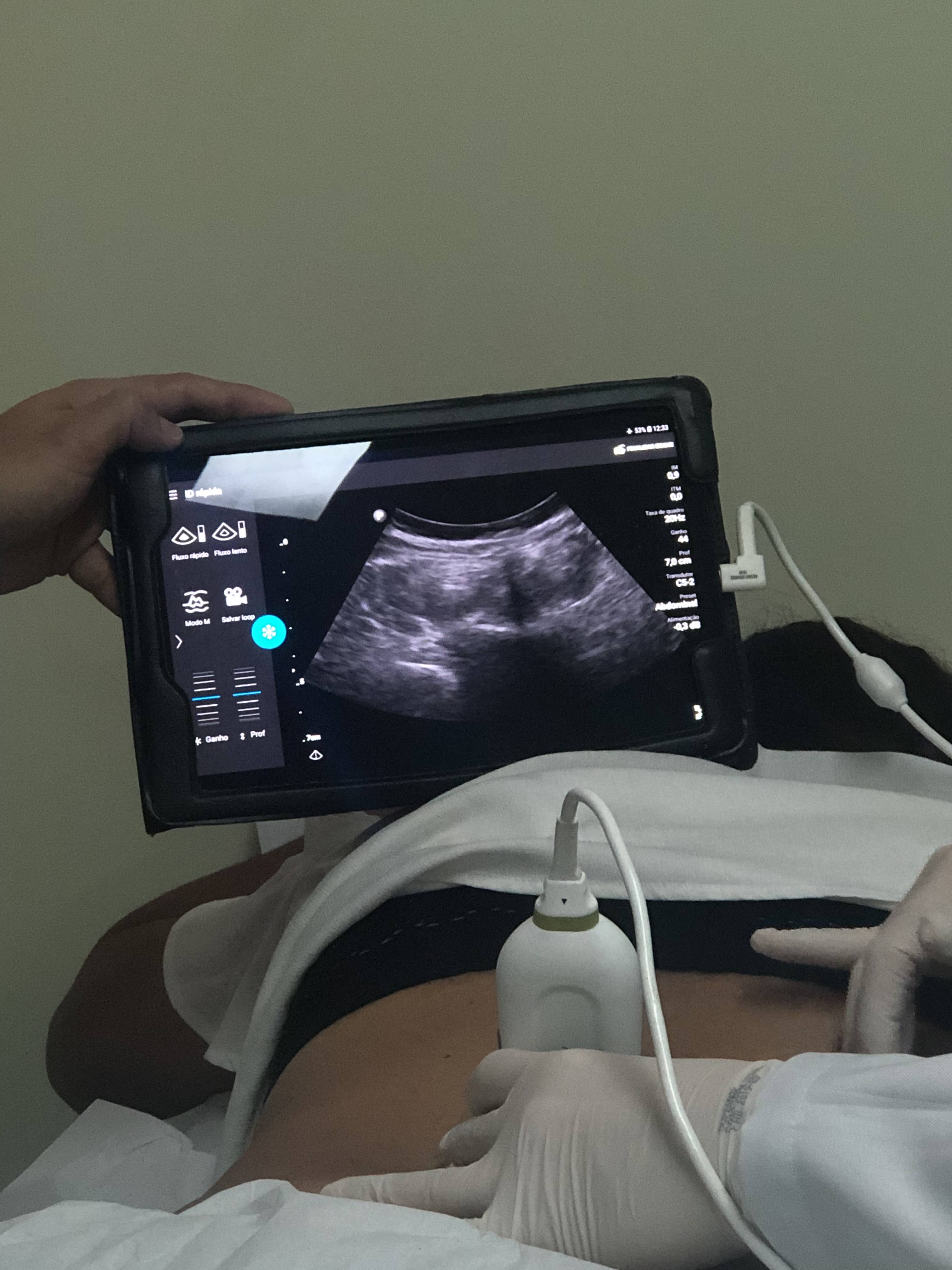 Intervenção guiada por ultrassom para dor em coluna vertebral - AME Interlagos - Pós-graduação em dor - Hospital Sírio-Libanês - SP - 2019 Intervenção guiada por ultrassom para dor em coluna vertebral - AME Interlagos - Pós-graduação em dor - Hospital Sírio-Libanês - SP - 2019