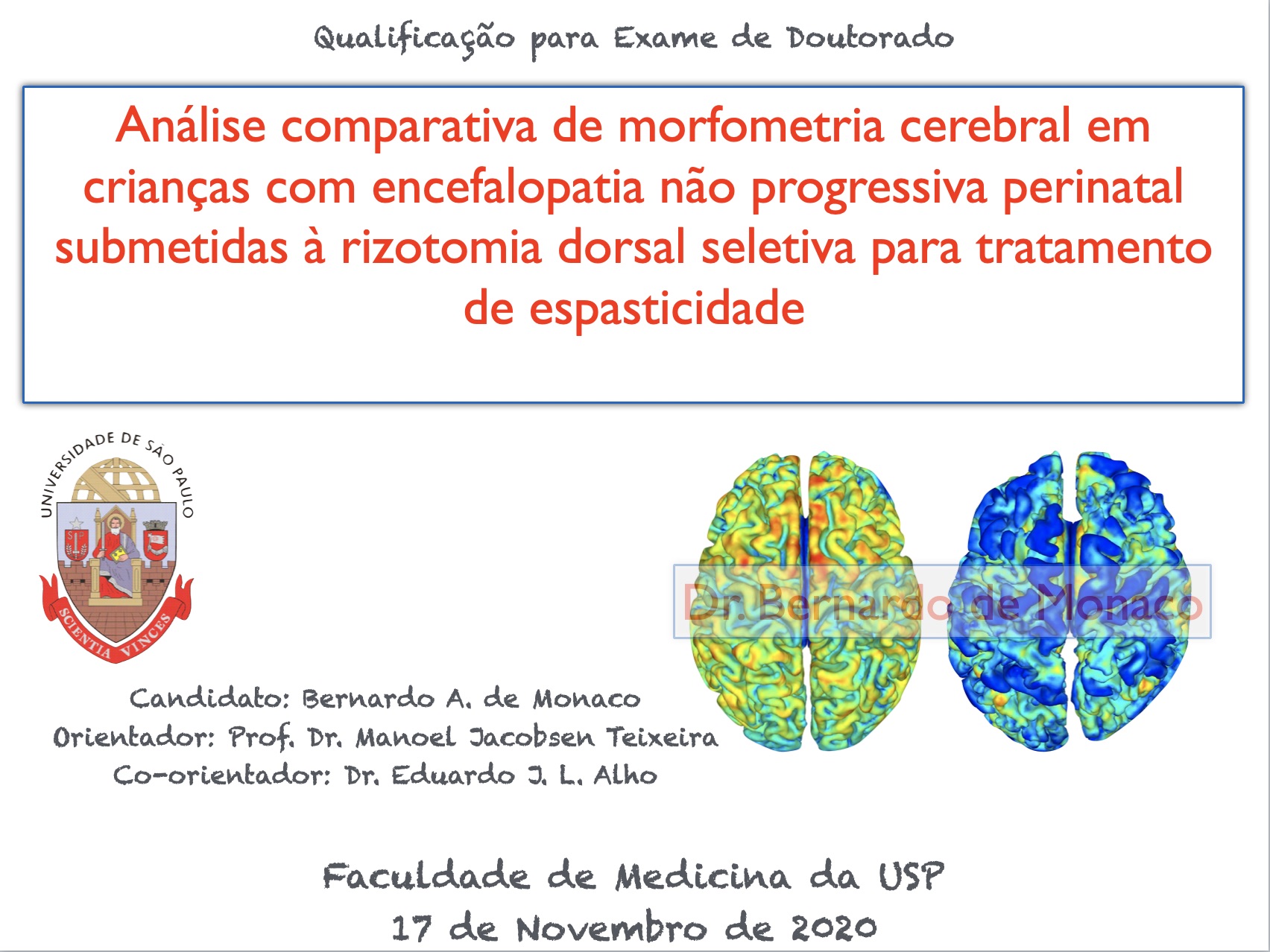 Defesa de qualificação para o doutorado - USP - Dr. Bernardo de Monaco - 2020 Defesa de qualificação para o doutorado - USP - Dr. Bernardo de Monaco - 2020